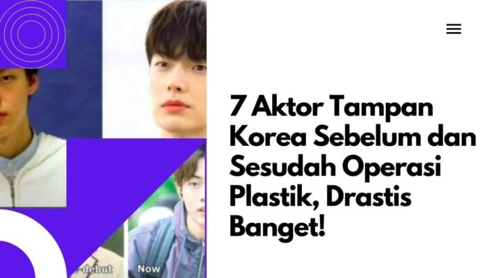 7 Aktor Tampan Korea Sebelum dan Sesudah Operasi Plastik, Drastis Banget!