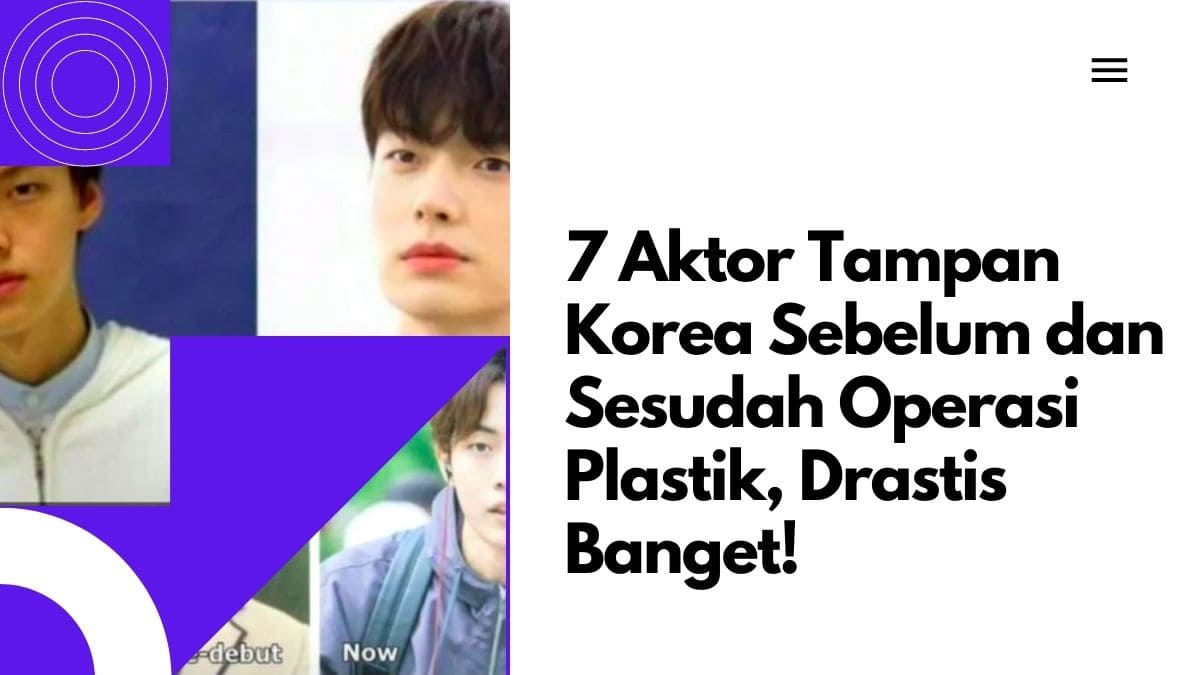 7 Aktor Tampan Korea Sebelum dan Sesudah Operasi Plastik Drastis Banget 7 Aktor Tampan Korea Sebelum dan Sesudah Operasi Plastik, Drastis Banget!